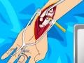 Mchezo Arm surgery 2