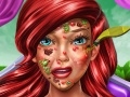 Mchezo Princess Mermaid Skin Doctor