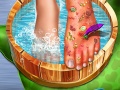 Mchezo Feet Skin Doctor
