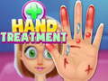 Mchezo Hand Treatment