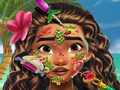 Mchezo Moana Skin Doctor