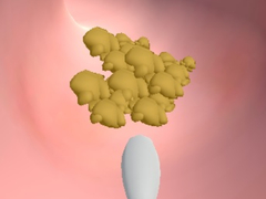 Mchezo Earwax Clinic